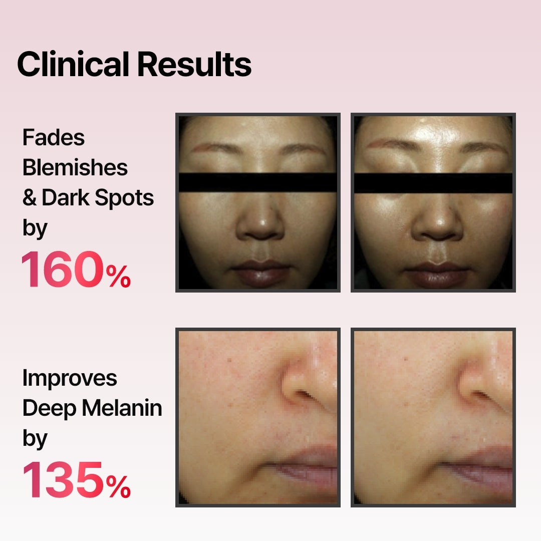 Arbutin Skin Booster Serum