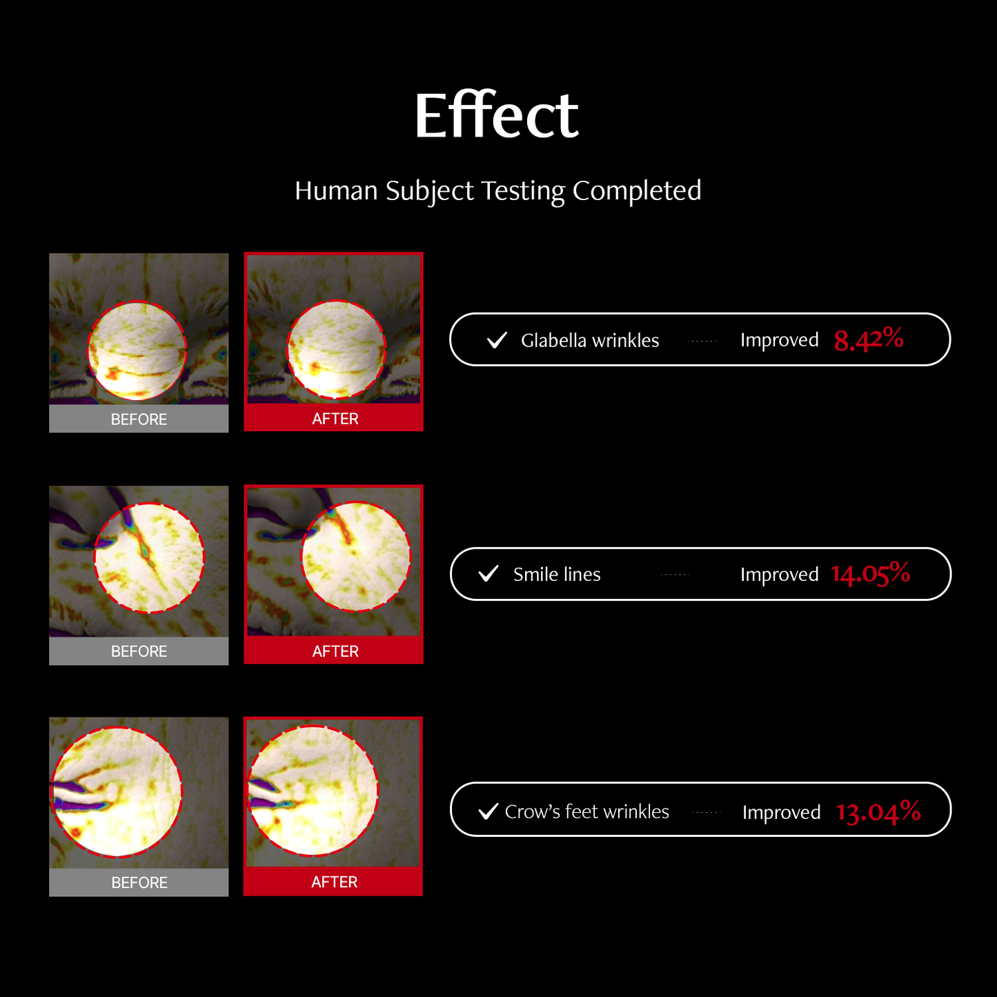 Shumage Retinol 550 Deep Shot Patch