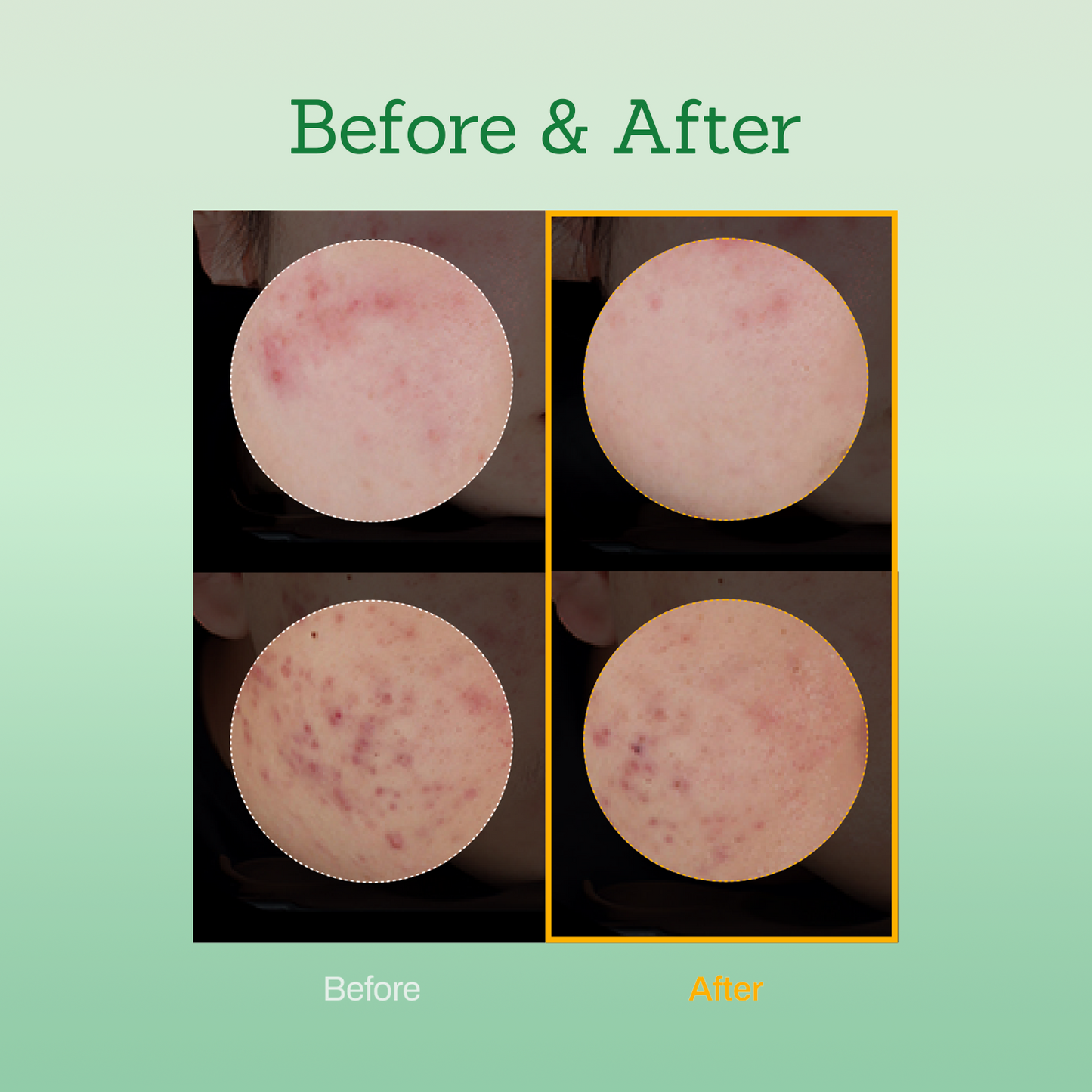 Mugwort Super Calming Toner + Serum