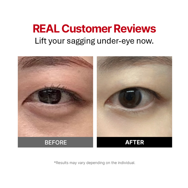 Wrinkle-fit Tangle Eye Cream