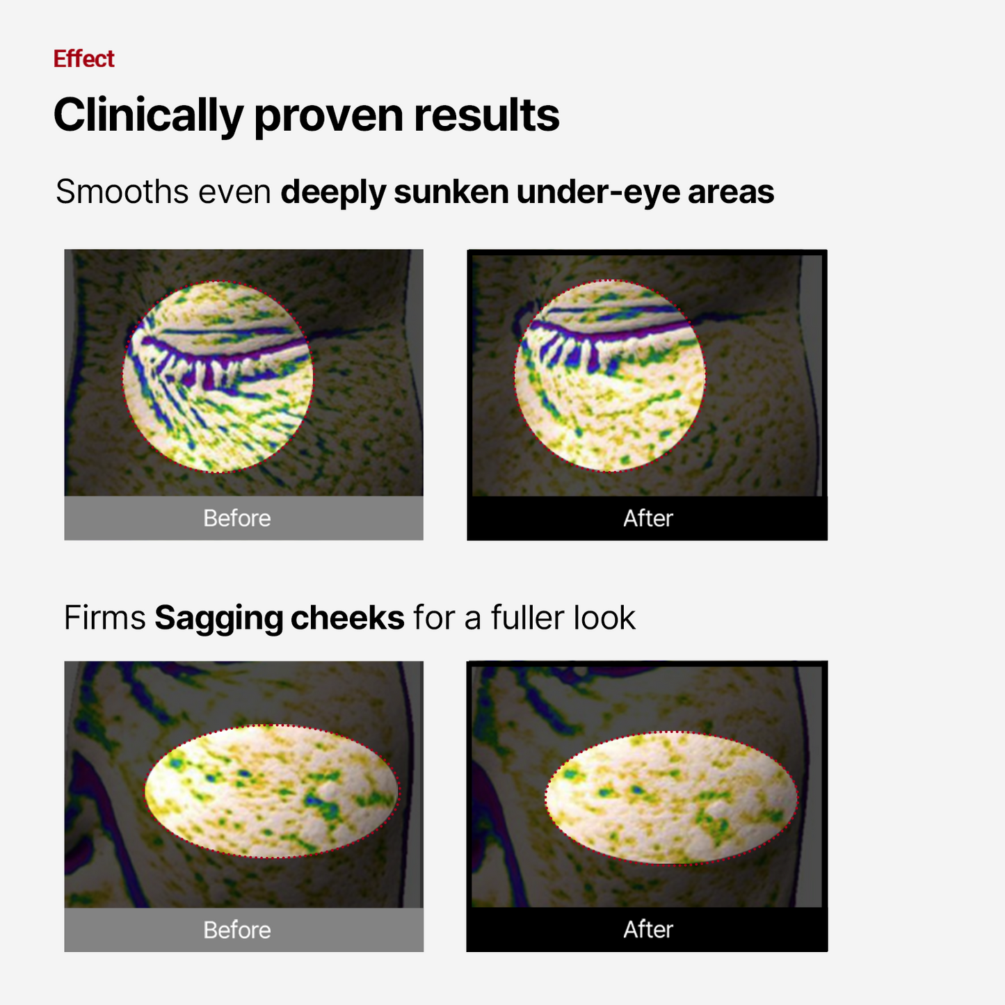 Wrinklefit Tangle Eye Patch