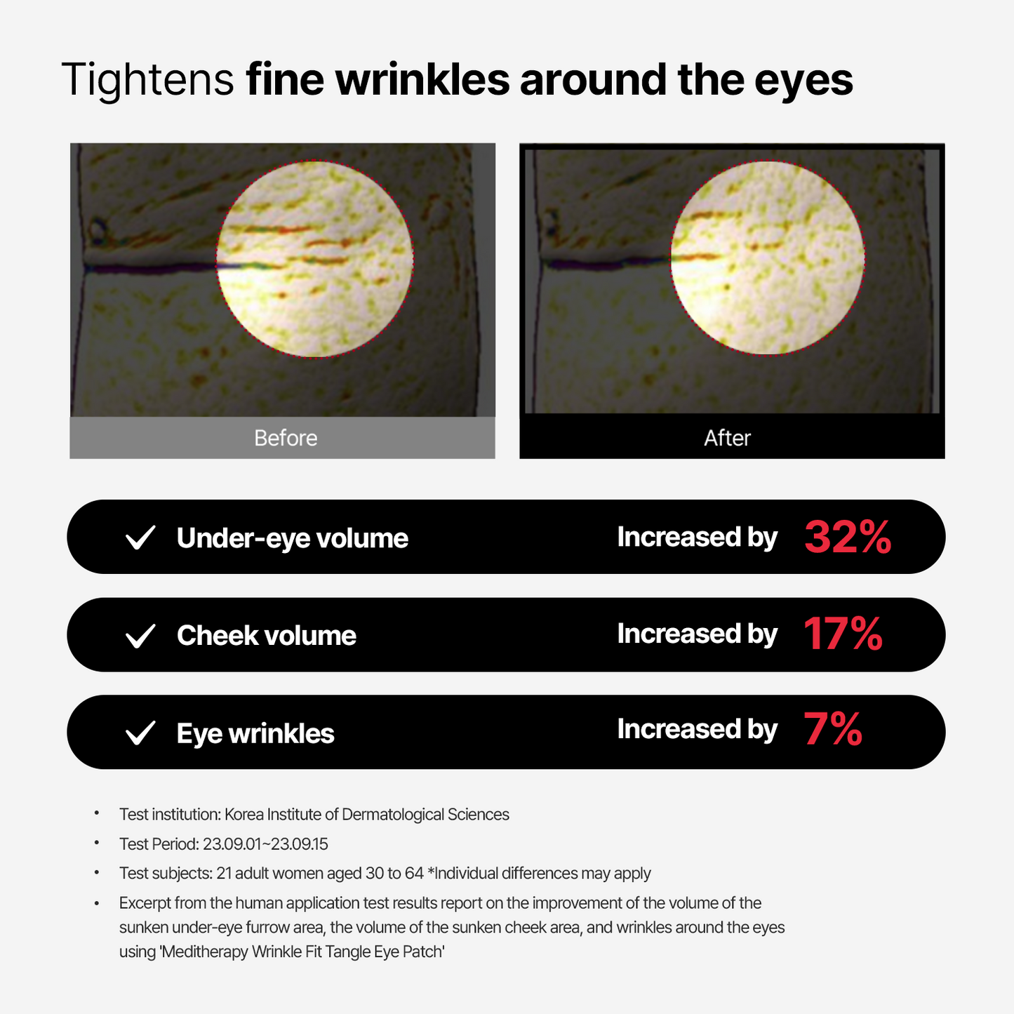 Wrinklefit Tangle Eye Patch
