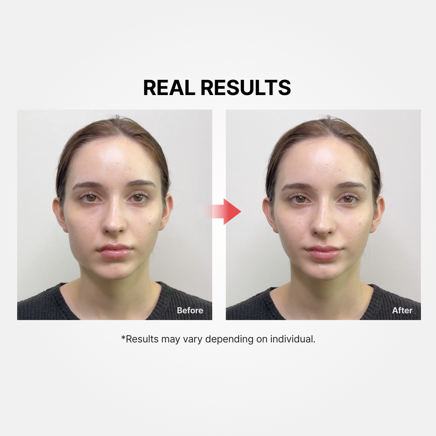 Shumage Gold Seal Lifting Cream + Device