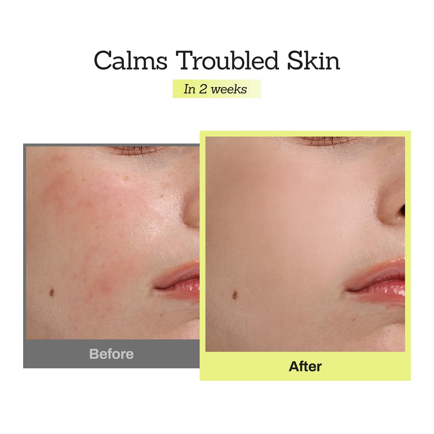 Mugwort Super Calming Toner + Serum