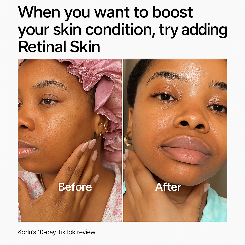 Amazon's #1 Retinal Serum – Encore Deal $13.99