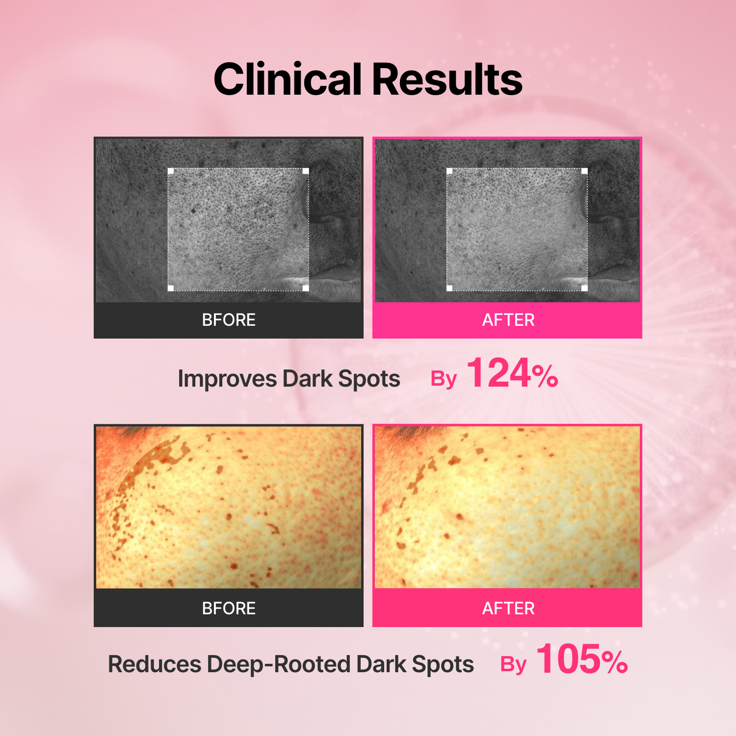 Tranexamic Acid Skin Booster Cream