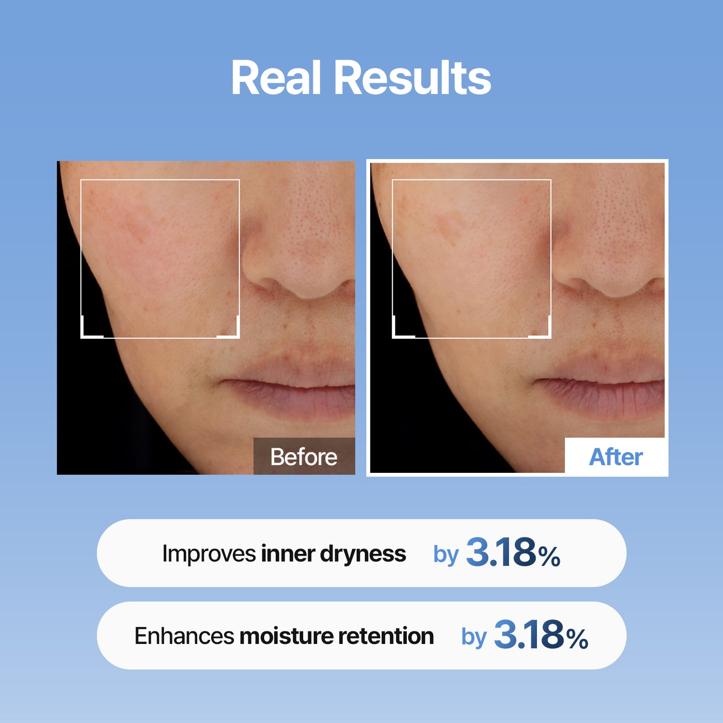 [28% OFF | $17.99] Hyaluronic Acid Skin Booster First Serum - 333Serum | Best Deal