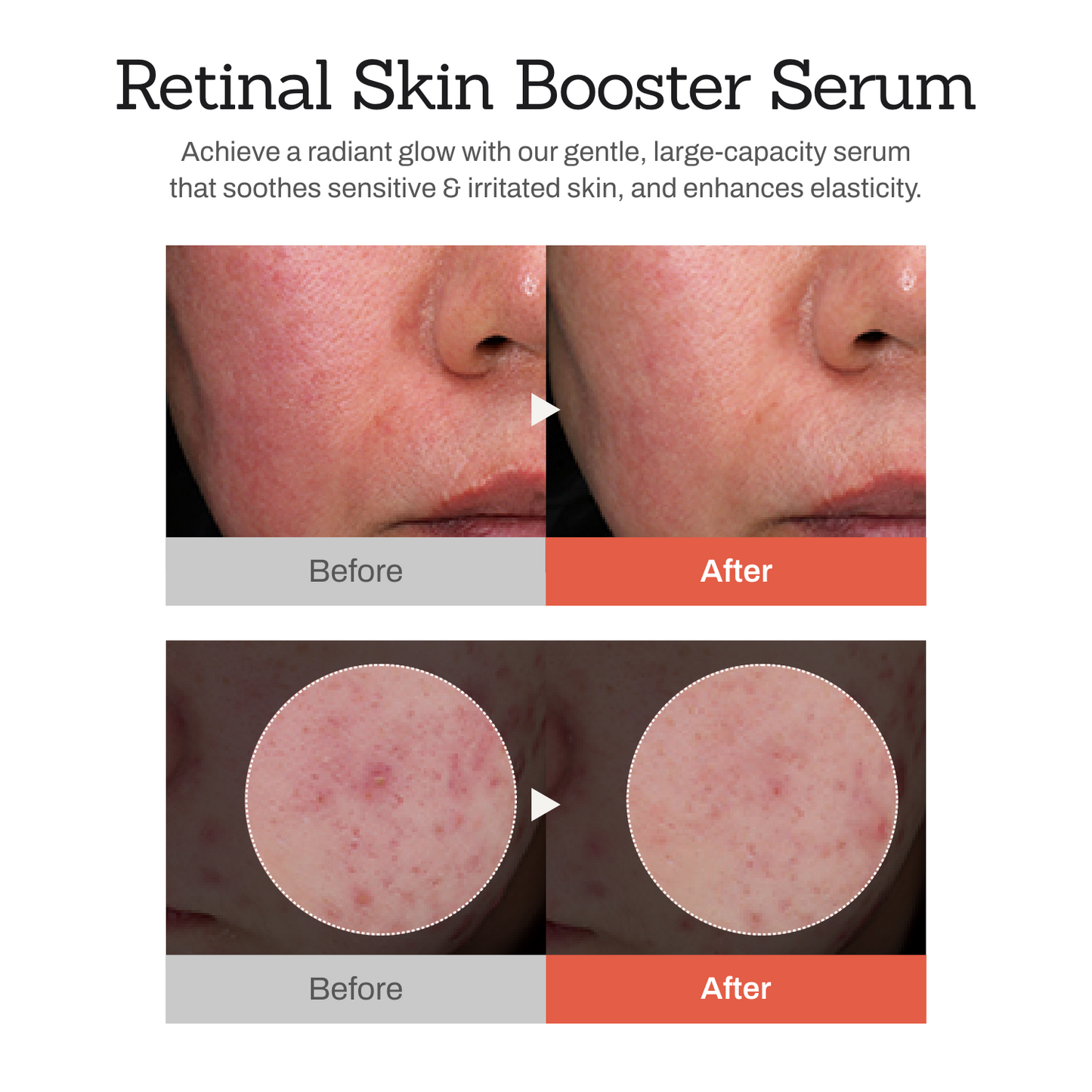 Retinal Skin Booster – All-in-One Glow Reset