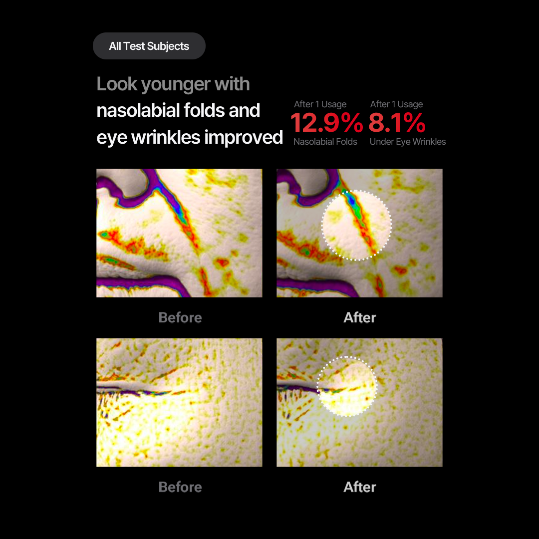 Shumage Gold Seal Lifting Cream + Device